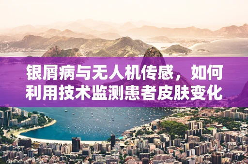 银屑病与无人机传感，如何利用技术监测患者皮肤变化？